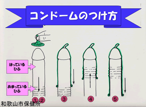 コンド ム 種類